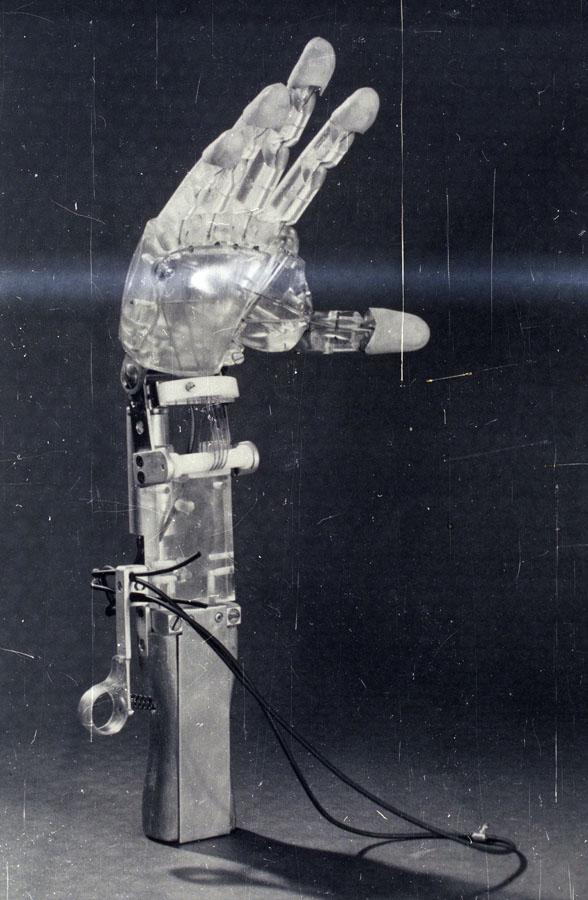 Prosthetic Hand Made In 1961